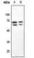 Anti-GAD1/2 Antibody